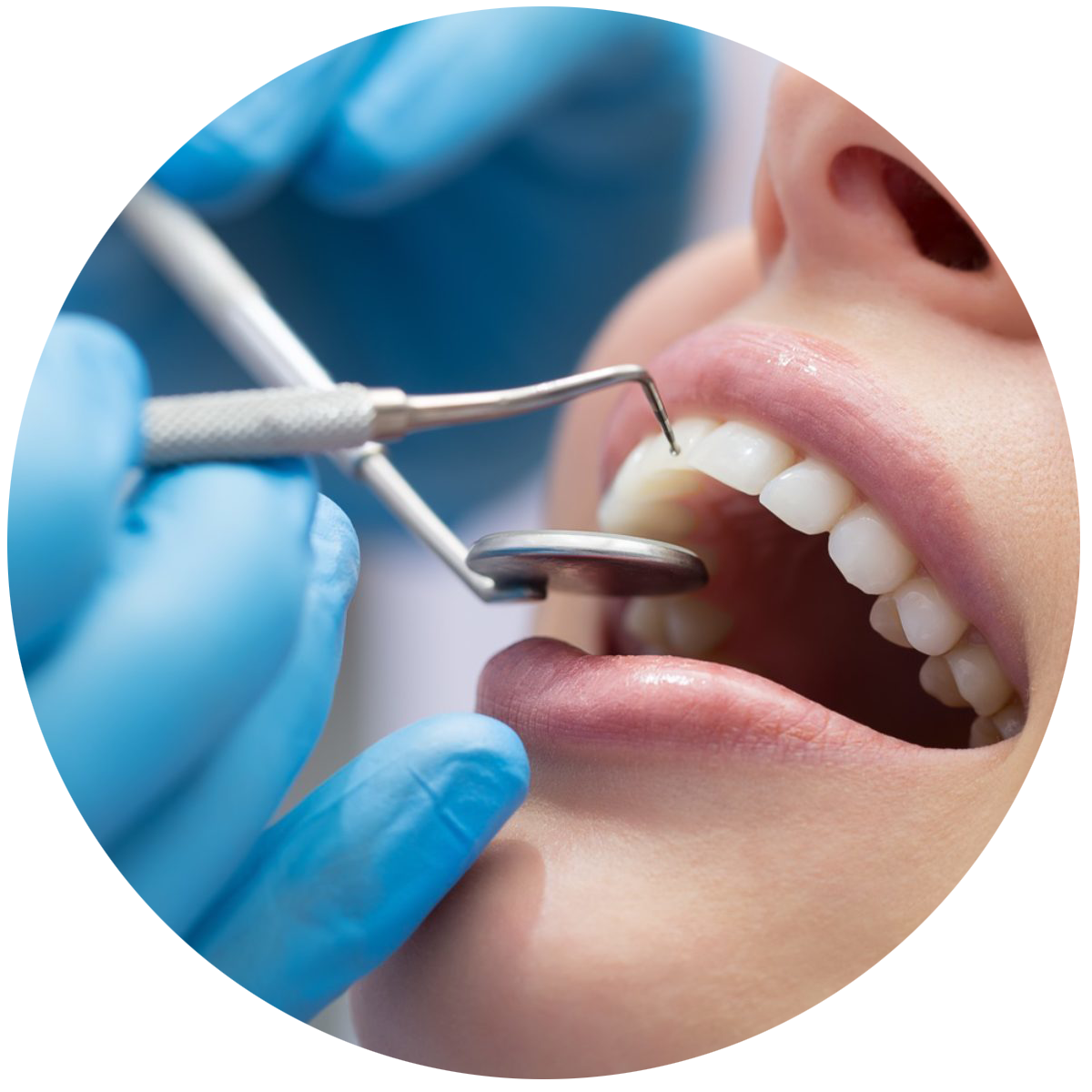 Терапия стоматология. Зубы с кариесом стоматология. Лечение кариеса ульяновск