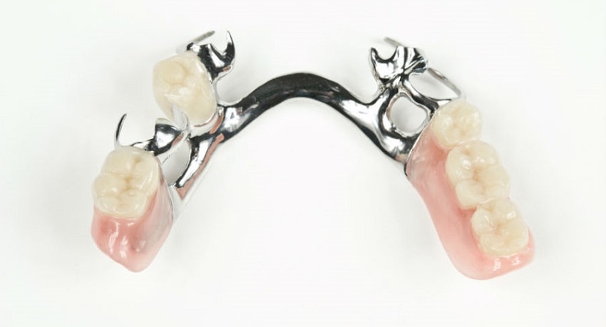 бюгельные протезы зубов