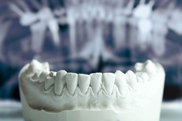Метафизика зубов фото